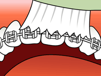 brushing-1