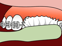 brushing-2