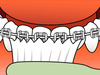 brushing-3