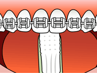 brushing-4